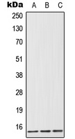 FABP1 Antibody