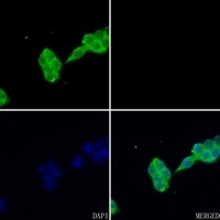 FABP1 Antibody