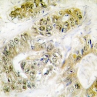 FANCA (phospho-S1149) antibody