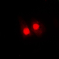 Anti-FANCA (Phospho-S1149) Antibody