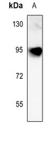 Fibulin 1 Rabbit Polyclonal Antibody