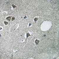 Anti-Fibulin 2 Antibody
