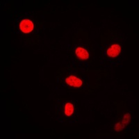 Anti-FEN1 Antibody