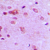 Anti-c-FER Antibody