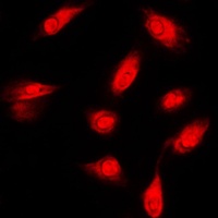 Anti-c-FER Antibody