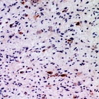 Anti-FGF5 Antibody