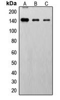 FGFR1 (Phospho-Y766) Antibody