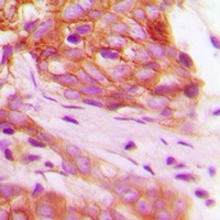 FGFR1 (Phospho-Y766) Antibody