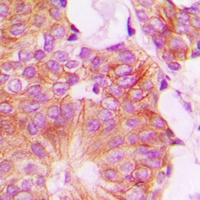 Anti-FHIT Antibody
