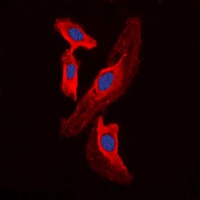 FHIT antibody