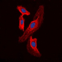 Anti-FHIT Antibody