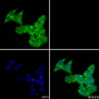 FHL2 antibody