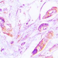 Anti-VEGFD Antibody