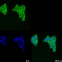 Anti-VEGFD Antibody