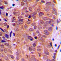 FOXO1 (phospho-S319) antibody