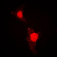 FOXO1 (phospho-S319) antibody