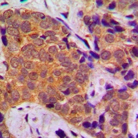 FOXO1 Antibody