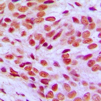 Anti-FLI1 Antibody