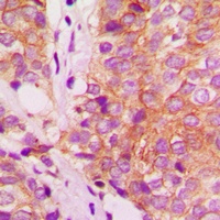 Filamin A Rabbit Polyclonal Antibody