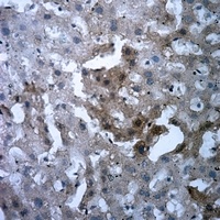 Anti-FR gamma Antibody