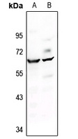 c-FOS Rabbit Polyclonal Antibody