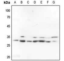 FRA2 Antibody