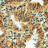 Anti-FPR1 Antibody