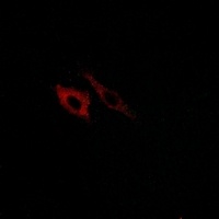 Anti-FPR1 Antibody