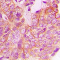 Anti-FRK Antibody