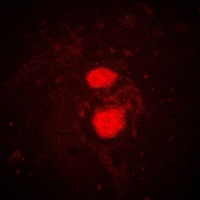 Anti-FRK Antibody