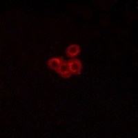 FSHR antibody