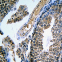 FSHR antibody