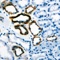Anti-Gastrin Antibody
