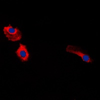 Gastrin Receptor antibody