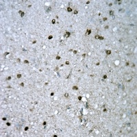 Anti-FYB Antibody