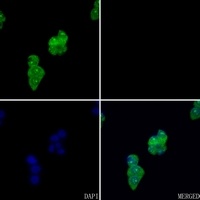 Anti-FYB Antibody