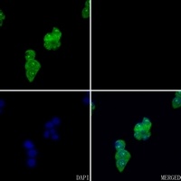 FYB antibody