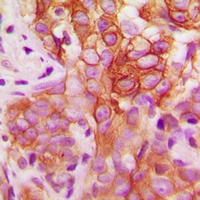 Anti-FYN (Phospho-Y530) Antibody