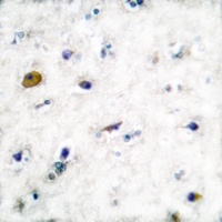 Anti-GABBR1 Antibody