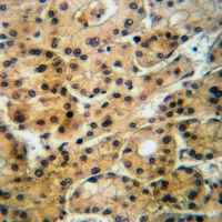 Anti-GABRA4 Antibody