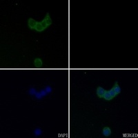 Anti-GABRA4 Antibody