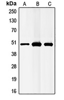 GABRB1 Rabbit Polyclonal Antibody