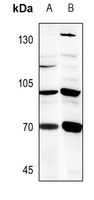 B4GALNT1 Antibody