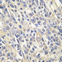 Anti-Galactose Kinase Antibody