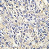 GALK1 antibody