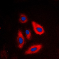 Anti-Galactose Kinase Antibody