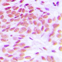 Anti-GATA1 Antibody
