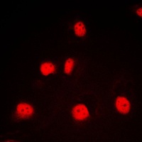Anti-GATA1 Antibody