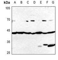 GATA4 Antibody