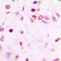 GATA4 Antibody